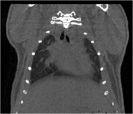 正常.jpg 正常.jpg